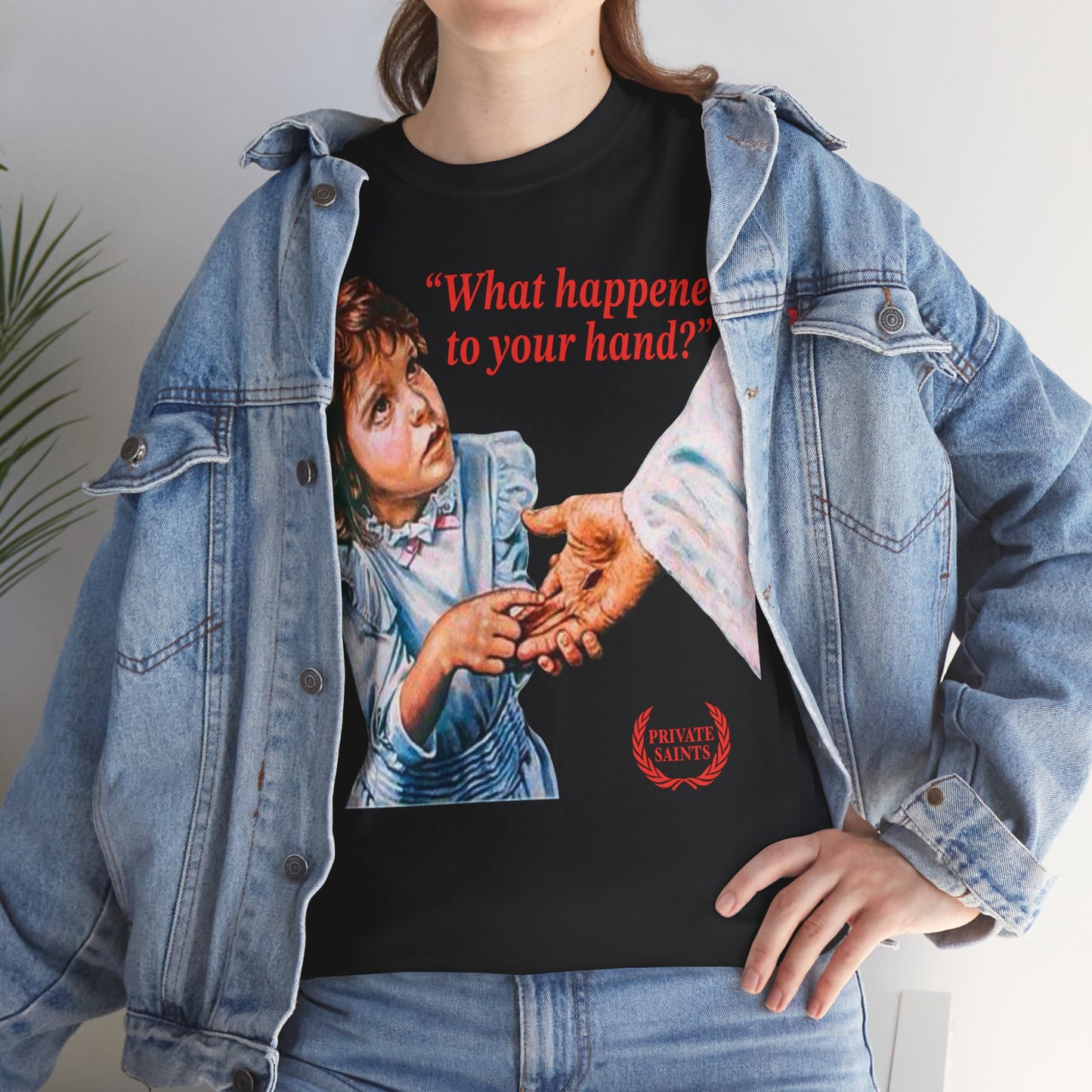 What happened to your hand?