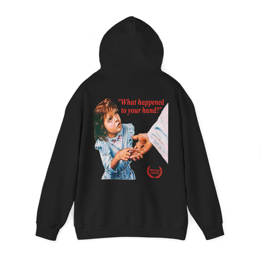 What happened to your hand?