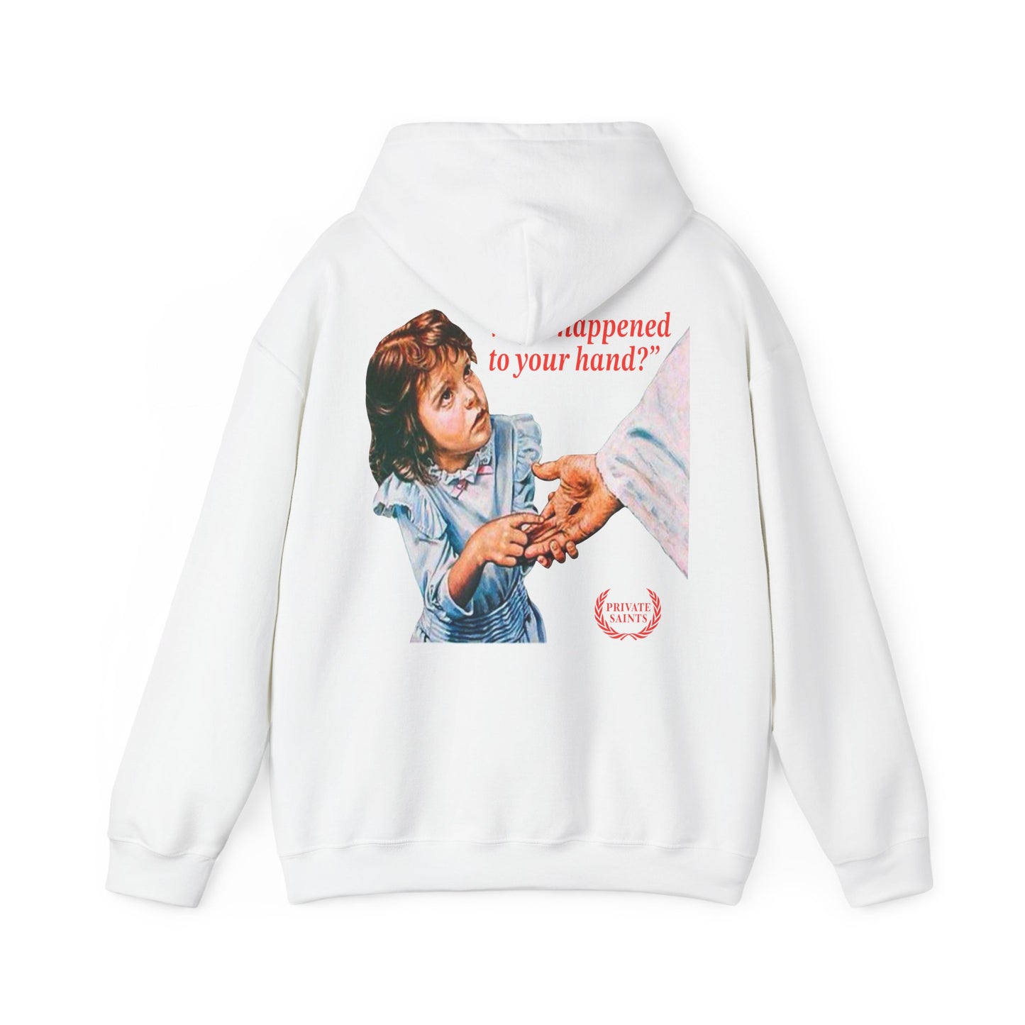 What happened to your hand?