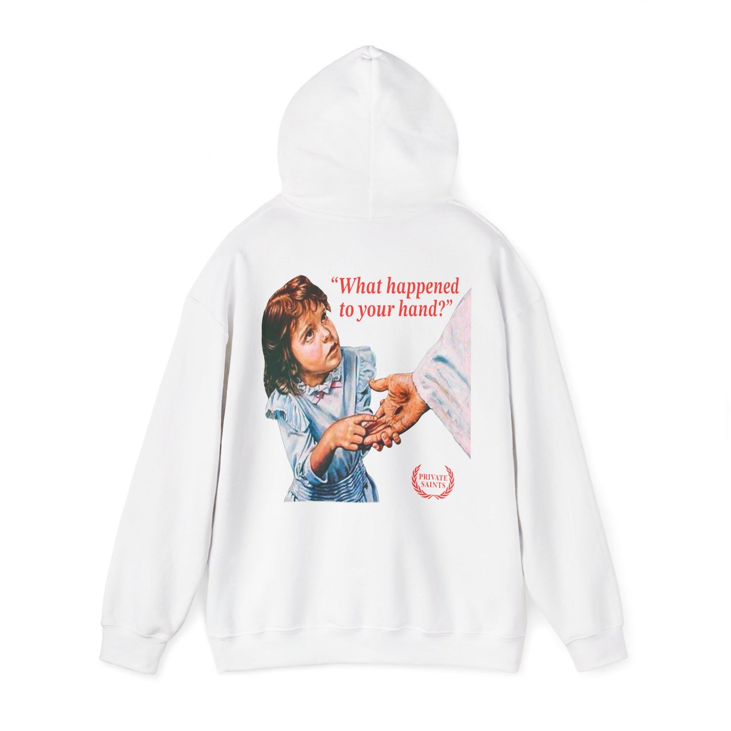 What happened to your hand?