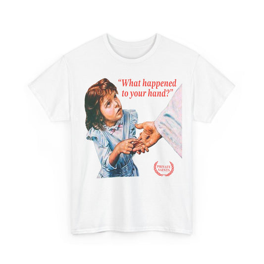 What happened to your hand?